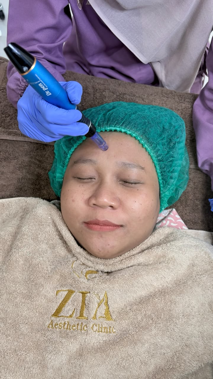 Sebelum - Exosome Premium