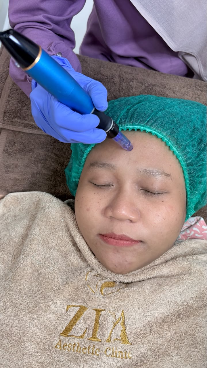 Sesudah - Exosome Premium